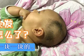 娃娃的头发一块一块的，到底是怎么了？别人说是理发伤到了毛囊？视频封面
