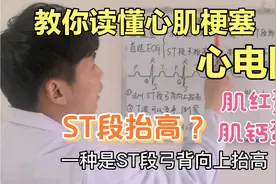 心肌梗死首选和最有意义的检查？教你读懂心梗的心电图#健康科普#视频封面