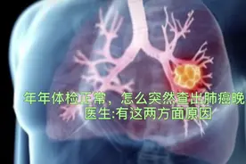 年年体检正常，怎么就突然查出肺癌晚期？医生:有两方面原因视频封面