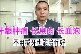 牙龈肿痛、长息肉、长血泡，不用拔牙也能治疗好。视频封面