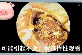 舒适解压的高能采耳来了，既舒服又解压！视频封面