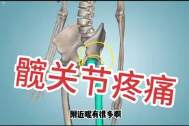 推拿必备知识，髋关节疼痛，3种常见原因，带你了解一下。视频封面