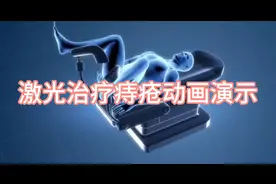 激光治疗痔疮过程动画演示！视频封面