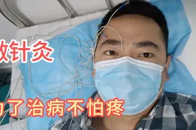 老纪去医院做电针灸，为了治头痛病头上扎银针，这种感觉太酸爽视频封面