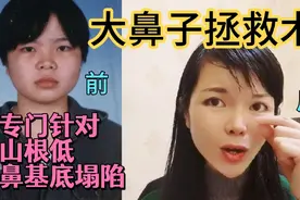大鼻子拯救术！专门针对山根低，鼻基底塌陷！每天10分钟徒手塑形