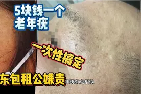 老年疣除了激光药水点斑，还可以这样做，成本一次不到5元！视频封面