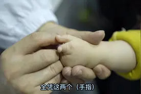 宝宝出生就只有三根手指，抓东西也很困难...视频封面