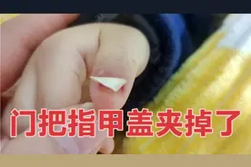 宝爸不小心把宝宝的手给夹了，指甲盖已经脱落，还能长出新的来吗视频封面