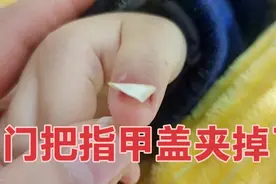 宝爸不小心把宝宝的手给夹了，指甲盖已经脱落，还能长出新的来吗