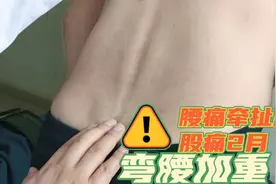 40岁中年男性腰痛牵扯屁股痛，经正骨结合分筋理筋手法治疗一幕视频封面