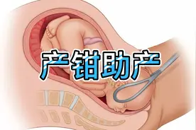 #产钳助产操作演练 当宝宝生不下来怎么办？视频封面