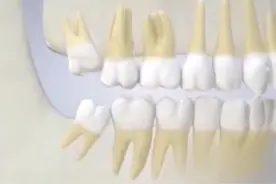 长智齿疼痛的小妙招视频封面