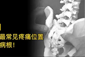 骨盆处最常见疼痛位置真正病根，为您解密！曹修行原发点疗法掌门视频封面