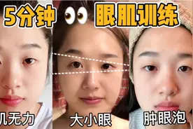5分钟眼肌训练👀大眼操，眼睑肌无力👋视频封面