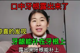 牙龈盖不住牙根了，没想到，医学发达牙龈也能给补上了@西瓜视频视频封面