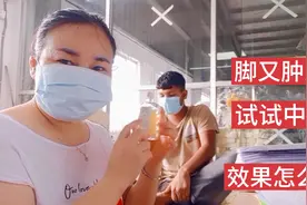 孟加拉小伙摔到脚又痛又肿 ，给他试试中国药 ，擦完效果真不错视频封面