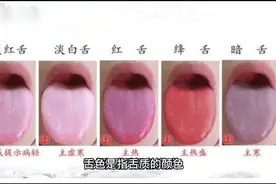 舌诊——望舌色诊病概述视频封面