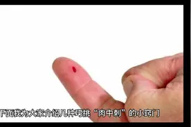 手脚被扎刺的解决方法视频封面