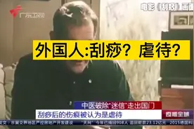 外国人感受过刮痧后开始赞叹视频封面