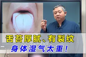 舌苔白腻、中间有裂纹？其实是湿气重的表现！中医教你健脾利湿视频封面