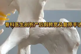 骨科医生剖析产后假胯宽及复原手法视频封面