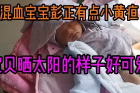 中国尼泊尔混血宝宝彭正有点小黄疸，宝贝晒太阳的样子好可爱视频封面