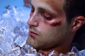男子一觉醒来，发现他的肾被人摘走了，这也太不可思议了视频封面