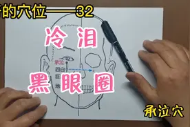 神奇的穴位——承泣穴可以改善黑眼圈，也可以用于冷泪。视频封面