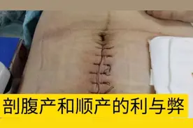 顺产和剖腹产各有利弊在能顺产的情况下尽量顺产新生儿健康聪明。视频封面