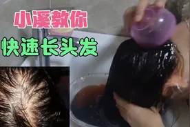 油性脱发太可怕，控油排油疏通毛囊最重要，视频分享养发干货视频封面