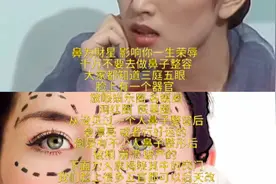 巩俐的鼻子很好看 鼻为财星 影响重大千万不要去整形做鼻子整容视频封面