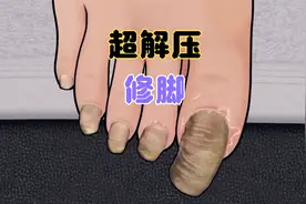你修过脚吗？超逼真沉浸式修脚全过程(剧情需要 请勿模仿)