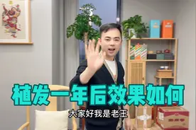 老王一年前花3万块植发 效果很满意 终极篇解说到底是不是智商税视频封面