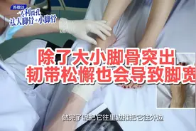 除了大小脚骨突出，韧带松懈也会导致脚宽视频封面