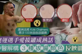 奧運選手愛拔罐成熱話　中醫解構3種拔罐顏色反映健康视频封面