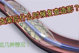 冠脉支架植入后要复查造影吗？医生给你详细解答！视频封面