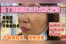 真人实拍用了美白淡斑霜35天效果，终于摆脱黄脸婆称号，差点放弃视频封面