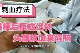 50岁患者脑梗1月半后出现反应迟钝思维下降，试试头部放血疗法视频封面