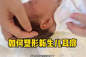 不到一分钱塑形新生儿耳廓视频封面