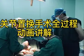 动画讲解：膝关节置换手术全过程！视频封面