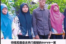 印度尼西亚一家五口都脸部变形 为什么只有一个女儿脸部没有变形视频封面