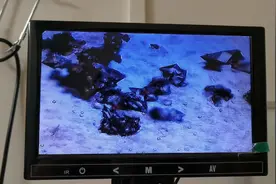 前列腺理疗+无痛尿道灌注，把堵塞的草酸钙结晶排出，后续在评论视频封面
