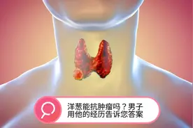 53岁男子坚持每天生吃洋葱抗肿瘤，半年后他怎么样了？视频封面