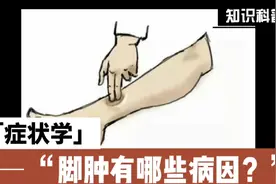 为什么会脚肿，脚肿有哪些病因？视频封面