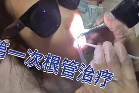 牙医爸爸在家给女儿治牙，第一次根管治疗，非专业人士请勿模仿视频封面