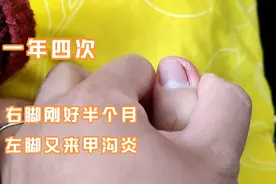 一年时间第四次 右脚甲沟炎刚好半个月 左脚又发了 真的是太难受视频封面