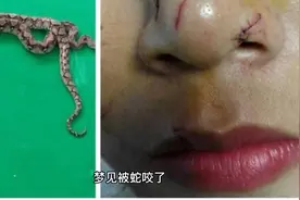 梦见被蛇咬了的预示视频封面