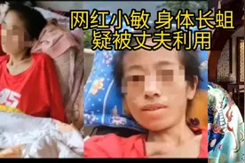 贵州抗癌网红被丈夫虐待身上长蛆？妇联：政府成立调查组，已送医视频封面