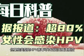 每日科普：超80%女性会感染HPV病毒视频封面