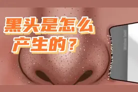 黑头是怎么产生的？80%的人不知道视频封面